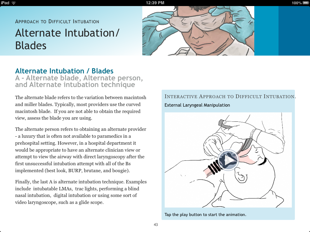 Page de contenu présentant la section Intubation alternative / Lames avec un texte explicatif accompagné d’une animation interactive intégrée illustrant la manipulation externe du larynx